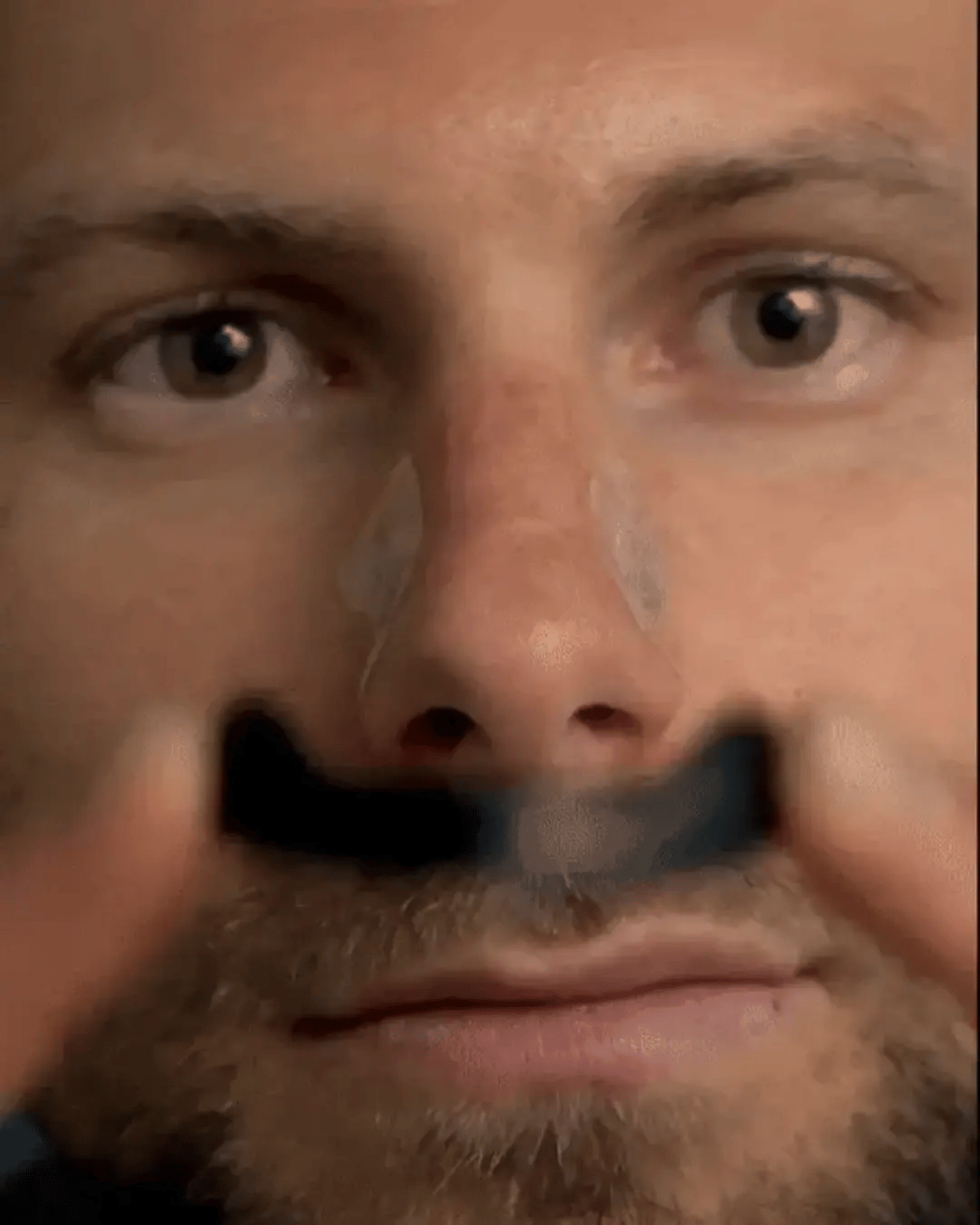 AirFlow™ — Dilatador Nasal Magnético